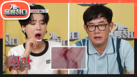 헌신과 정성으로 노력하는 임시보호자와 베니가 긴 시간 동안 같이 있게 된 이유..! | KBS 210830 방송