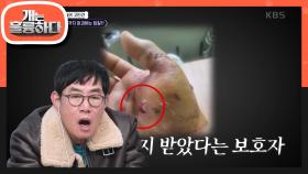 ＂물려서 근육 봉합술을 했습니다＂ 어느 날 제작진에게 접수된 제보 한 통!?😨 | KBS 240226 방송