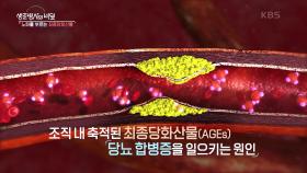 노화를 부르는 최종당화산물! “ 과잉된 당이 단백질에 들러붙어 변형을... ” | KBS 241002 방송