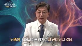 뇌종양 알면 극복한다! “ 뇌에서 다른 장기로 잘 전이되지 않음 ” | KBS 241120 방송