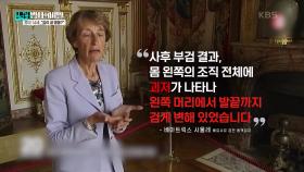 당시 루이 14세의 부검 기록, ‘발끝부터 머리까지 모든 근육에 괴저가 있었다’ | KBS 250121 방송