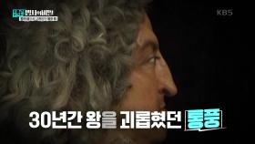 30년간 왕을 괴롭혔던 병의 정체는 ‘통풍’ | KBS 250121 방송
