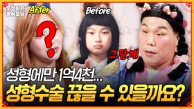 [풀버전] 성형 수술에만 1억4천... 이제 성형수술 그만하고 싶은데 끊을 수 있을까요?😮‍💨 [무엇이든 물어보살] | KBS Joy 250915 방송