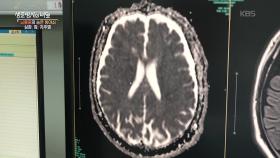 뇌졸중 치료법과 예방의 중요성 | KBS 250924 방송