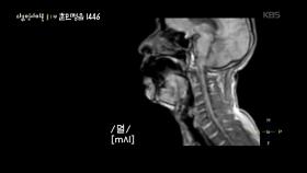 모음의 핵심 아래 아(●)의 음가를 찾아라 | KBS 251009 방송