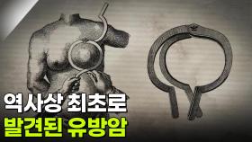 역사상 최초로 발견된 유방암 | KBS 251014 방송