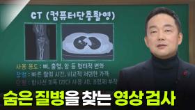 김영환 핵의학과 교수, 숨은 질병을 찾는 영상 검사 | KBS 251204 방송