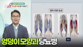 [무엇이든 팩트체크] 엉덩이 모양만 봐도 당뇨병 위험 알 수 있다? | KBS 251205 방송