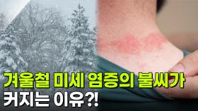 [굿모닝! 건강 브런치] 겨울 기미의 주범! 염증 | KBS 251211 방송