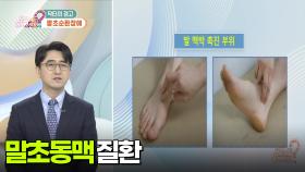 [닥터의 경고] 다리가 저리고 아파요! | KBS 251215 방송