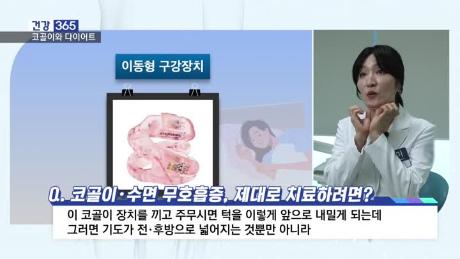 [건강365]-′드르렁 컥′ 코골이가 내 다이어트 망친다?