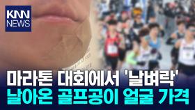 마라톤 중 골프공에 ′퍽′…＂CCTV 없어 누군지 몰라＂ / KNN