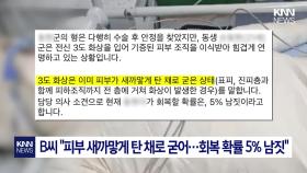 아버지 방화에 ′전신 화상′ 입은 아들...＂제발 제 친구를 도와주세요＂ / KNN