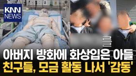 아버지 방화에 ′전신 화상′ 입은 아들...＂제발 제 친구를 도와주세요＂ / KNN