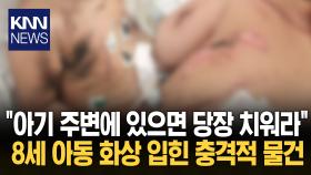 ＂휴대폰 충전하며 잠들었는데…＂ 감전 사고에 끔찍한 화상 ′충격′ / KNN
