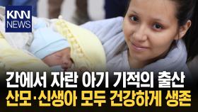 자궁 아닌 ′간′에서 태어난 아기 ＂동맥 통해 영양 공급 기적이야＂ / KNN