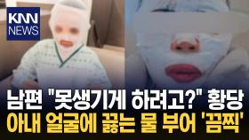 잠든 아내에 끓는 물 부은 남편 ＂못생기게 만들려고…＂ 경악 / KNN