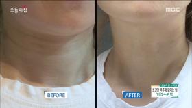 어려 보이게 만들어주는 