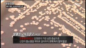 180도 바뀐 아이의 삶 원인은 햄버거?!