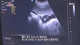 노산에 쌍둥이, 늘 불안한 엄마