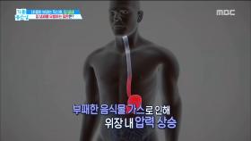 입 냄새를 유발하는 질환의 정체는?