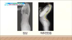 잘못된 자세 따라 살이 찐다?!