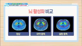 우리가 모르고 있었던 ＂ 당 중독 ＂의 실체