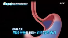 가볍게 여기다 우울증, 호흡곤란까지? 역류성 식도염의 위험!