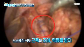 재발률 무려 80%, 고쳐야 산다!