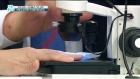 손톱 밑 실핏줄! 모세혈관을 살펴라?