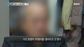 ＂그 정도 충격 아니고는...＂ 낙상사고가 의심되는 두개골 골절 사건