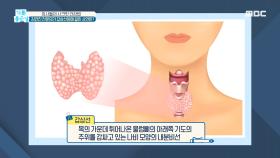 갑상선의 역할과 중요성은?