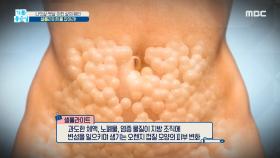 나잇살·뱃살·처진살의 원인 '셀룰라이트'를 잡아라!, MBC 210421 방송
