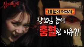 갑자기 충혈이 된 장모님 앞에 나타난 의문의 여성..😱｜내 눈이 어때서, MBC 210422 방송