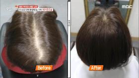 단 4시간 만에 풍성해지는 기적! 헤어증모술, MBC 210517 방송