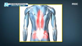 근육이 튼튼하면 통증 민감도가 줄어든다?, MBC 210521 방송