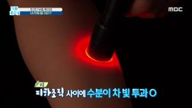 초간단 '부종' 확인법! 손전등🔦을 대라?!, MBC 210621 방송