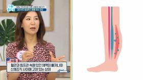 아침·저녁으로 다른 사람이 된다?! 머리부터 발끝까지 퉁퉁 붓는 이유!, MBC 210621 방송