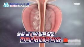종합감기약 완전 정복! 감기 만병통치약?, MBC 211004 방송