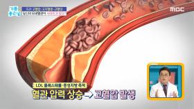 모세혈관이 사라지는 원인?, MBC 211013 방송