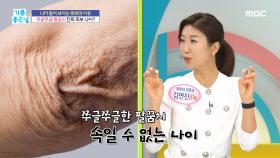 나이 들어 보이는 팔꿈치, 무릎 관리법!, MBC 211015 방송