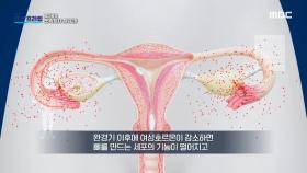 완경기 이후 여자들의 골다공증 치료가 더 중요한 이유, MBC 240121 방송