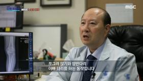 관절에 무리를 주는 한국의 양반다리 문화, MBC 240421 방송