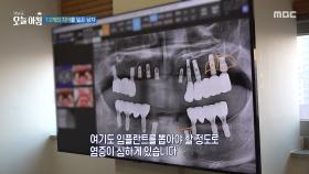 12개의 치아를 잃은 남자, MBC 251201 방송