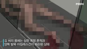 알몸 상태로 아킬레스건 잘려 잔인하게 살해된 남자?!