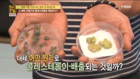 간 해독 요법으로 콜레스테롤을 배출한다?!