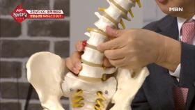 허리디스크 자가 진단법은?