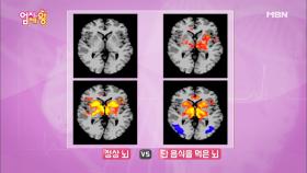 묵은살의 주범 '당'을 조심해라!