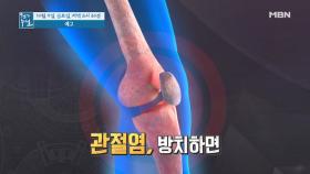 대한민국 관절 건강! 씨앗으로 보우(保佑)하라!