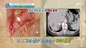 생존율 5%, 위암으로 고통받았던 그의 사연은?